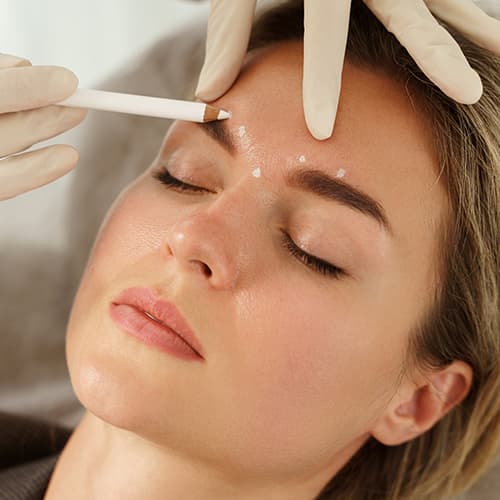 A close-up of a woman receiving a professional Botox cosmetic treatment on the forehead. A practitioner is marking injection points to target fine lines and forehead wrinkles for a smoother, more youthful appearance.
