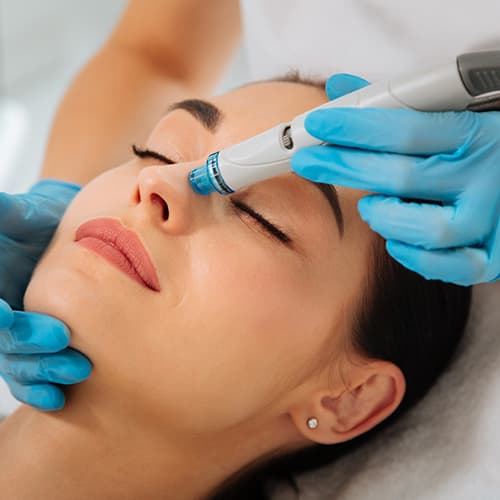 A close-up of a woman receiving a professional microneedling facial using a Dermapen device on the forehead and upper face. The image represents collagen induction therapy for skin rejuvenation, improved texture, reduced fine lines, and a healthier, more youthful complexion.