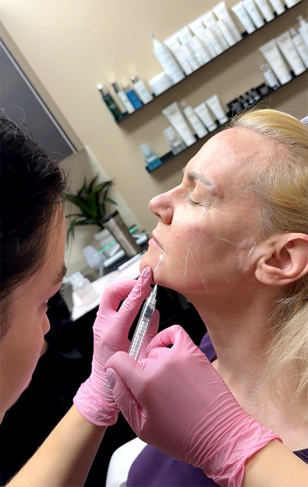 Baby Glow injections